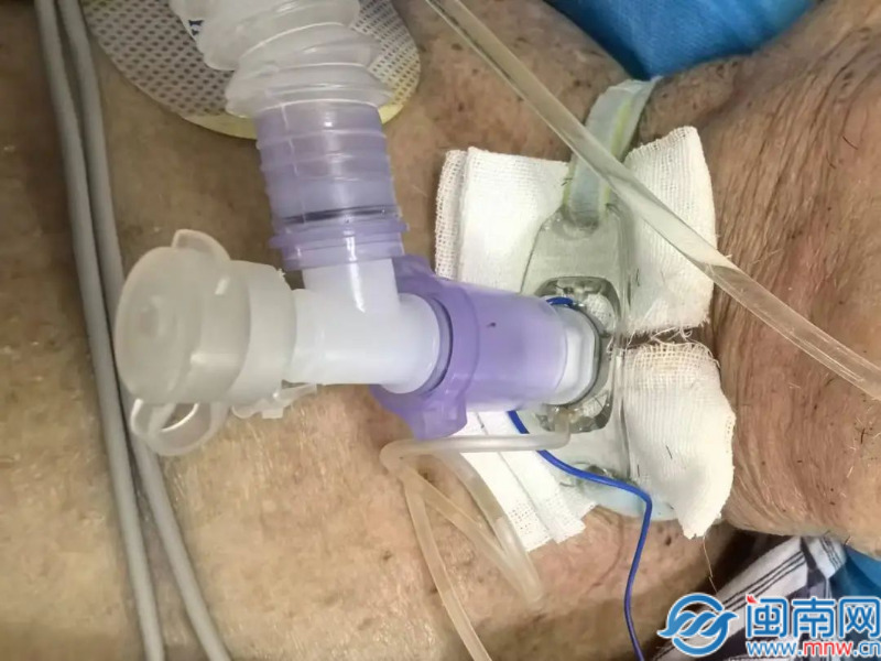 全县首例！云霄县医院在危重症患者救治范畴迈入新阶段