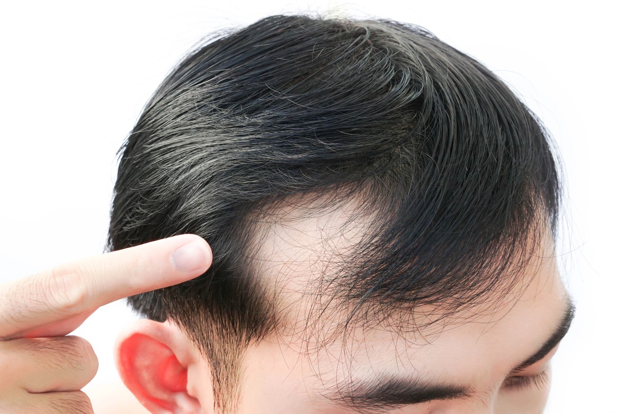 雍禾医疗，种得青丝难解愁