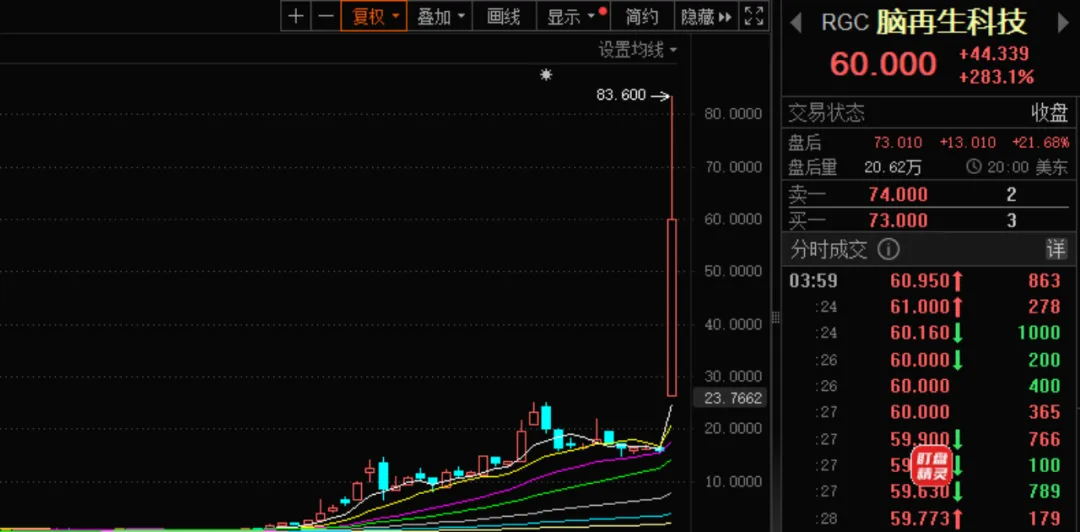 两大利好传来！刚刚脑机接口全线狂飙！