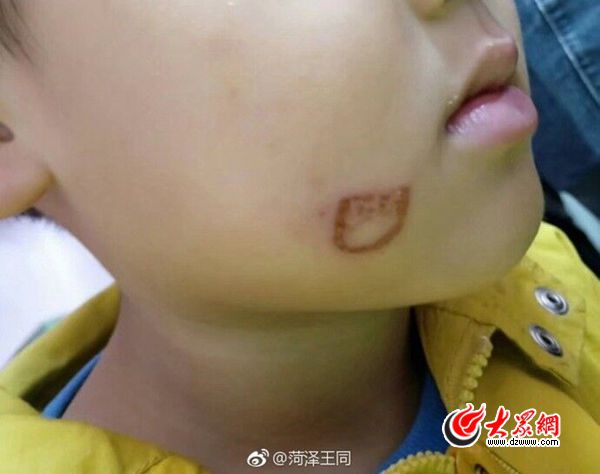 【抖音吃瓜】蠊虫是什么虫