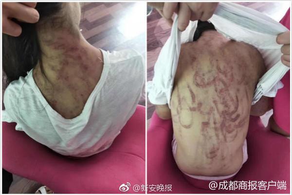 【51吃瓜网张津瑜完整版】“尽我所能协助需求协助的人”